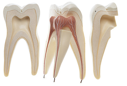 First Upper Molar with Three Roots