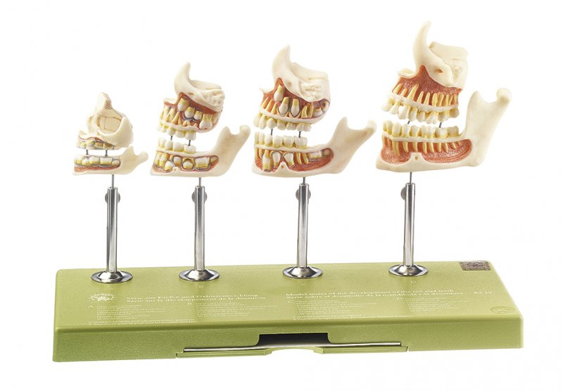 Development of a Set of Teeth ES 14 — Somso | Candent Canada
