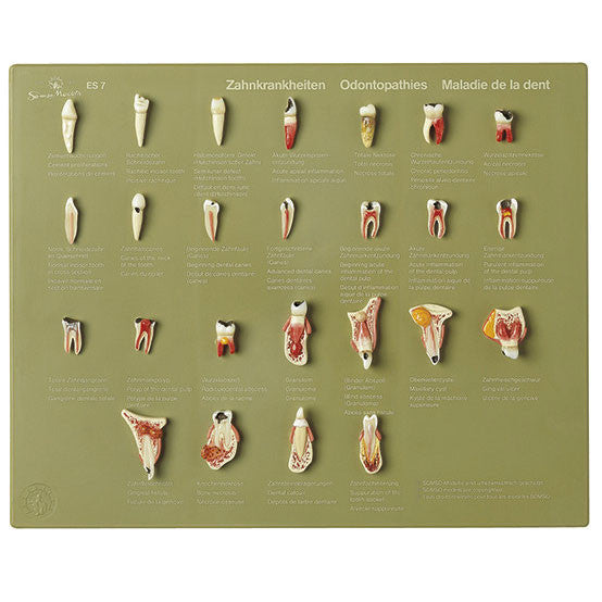 Case of Teeth "Odontopathies" Somso Es 7