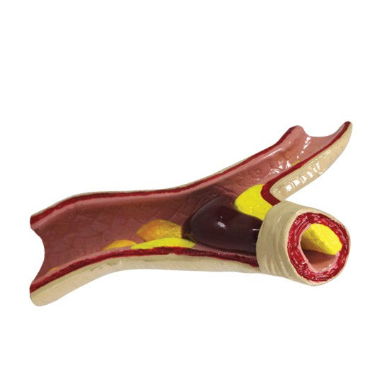 Hypertension Set (5x)