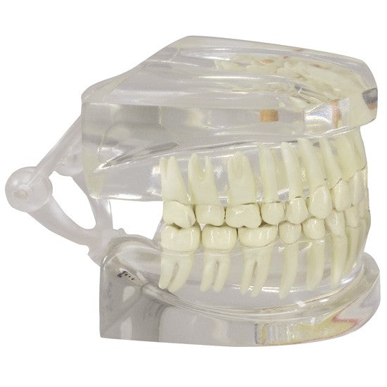 Clear Teeth (Healthy/Pathologies)