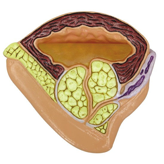 Male Pelvis with BPH Insert