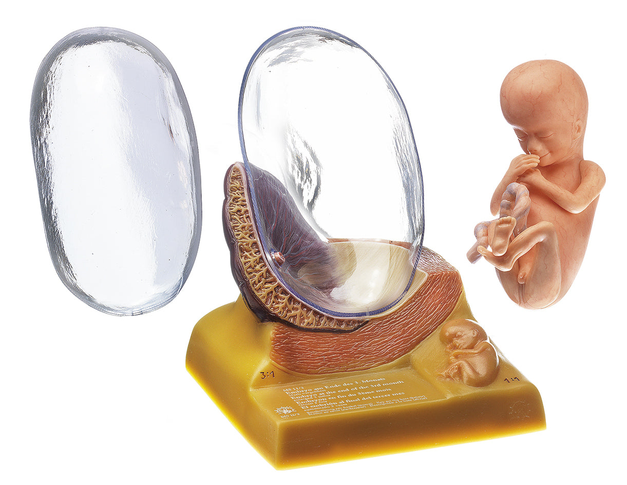 Human Embryo in the Third Month - Somso MS 11/3, view 3