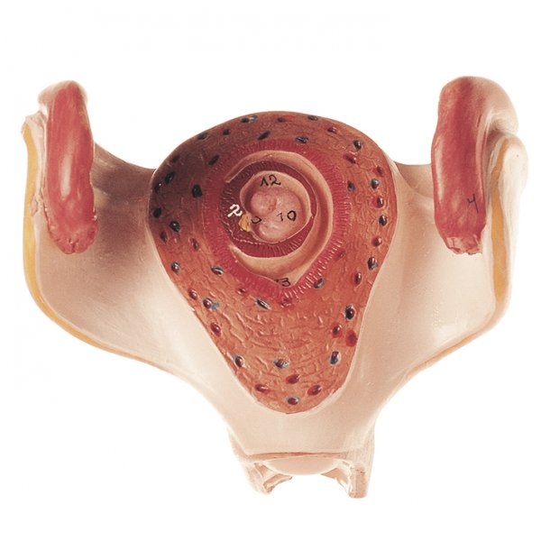 Uterus with Embryo in First Month - Somso MS 12/1