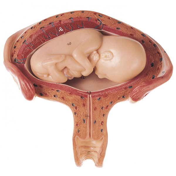 Uterus with Fetus in Fourth to Fifth Month - Somso MS 12/4