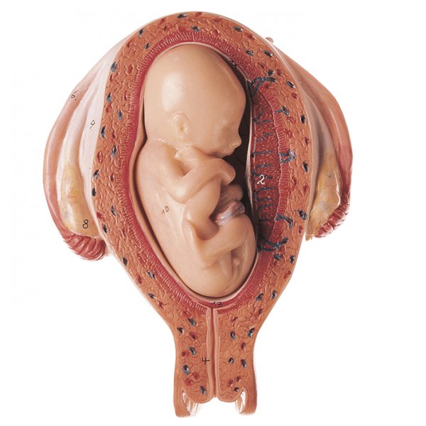 Uterus with Fetus in Fifth Month - Breech Position - Somso MS 12/5