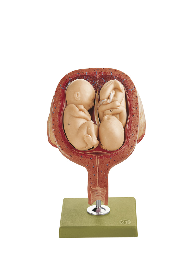 Uterus with Twin Fetuses in Fifth Month - Somso MS 12/8