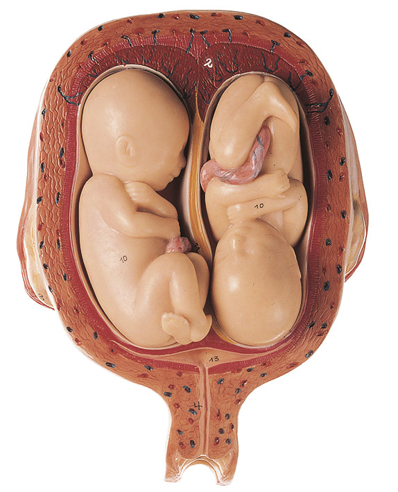Uterus with Twin Fetuses in Fifth Month - Somso MS 12/8, view 2