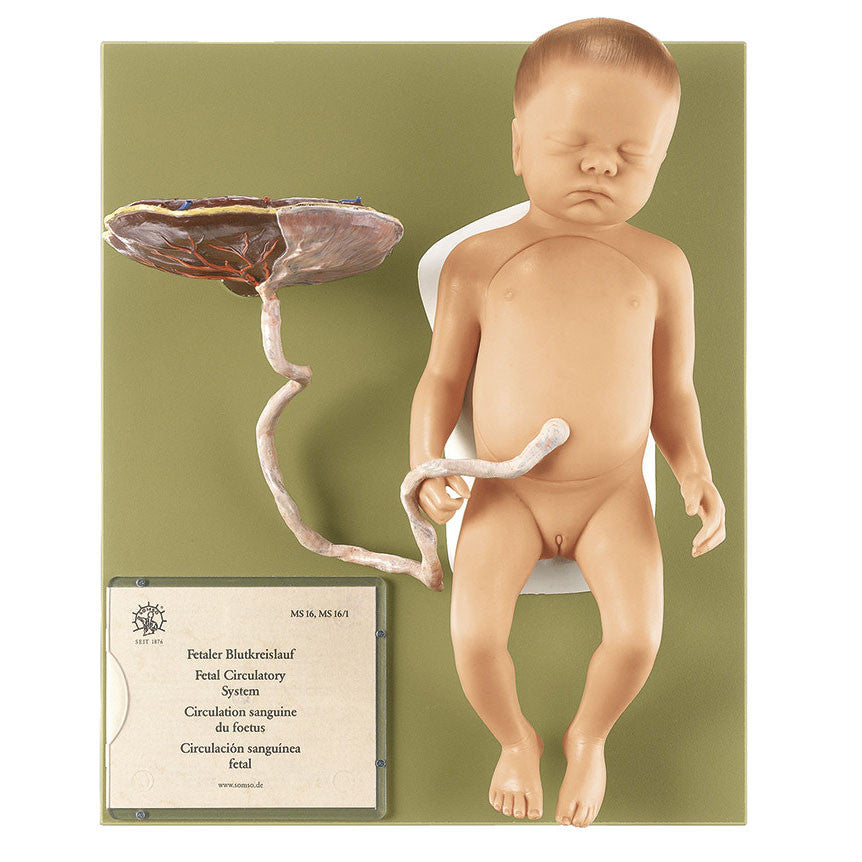 Female Fetus Somso Ms 16/1