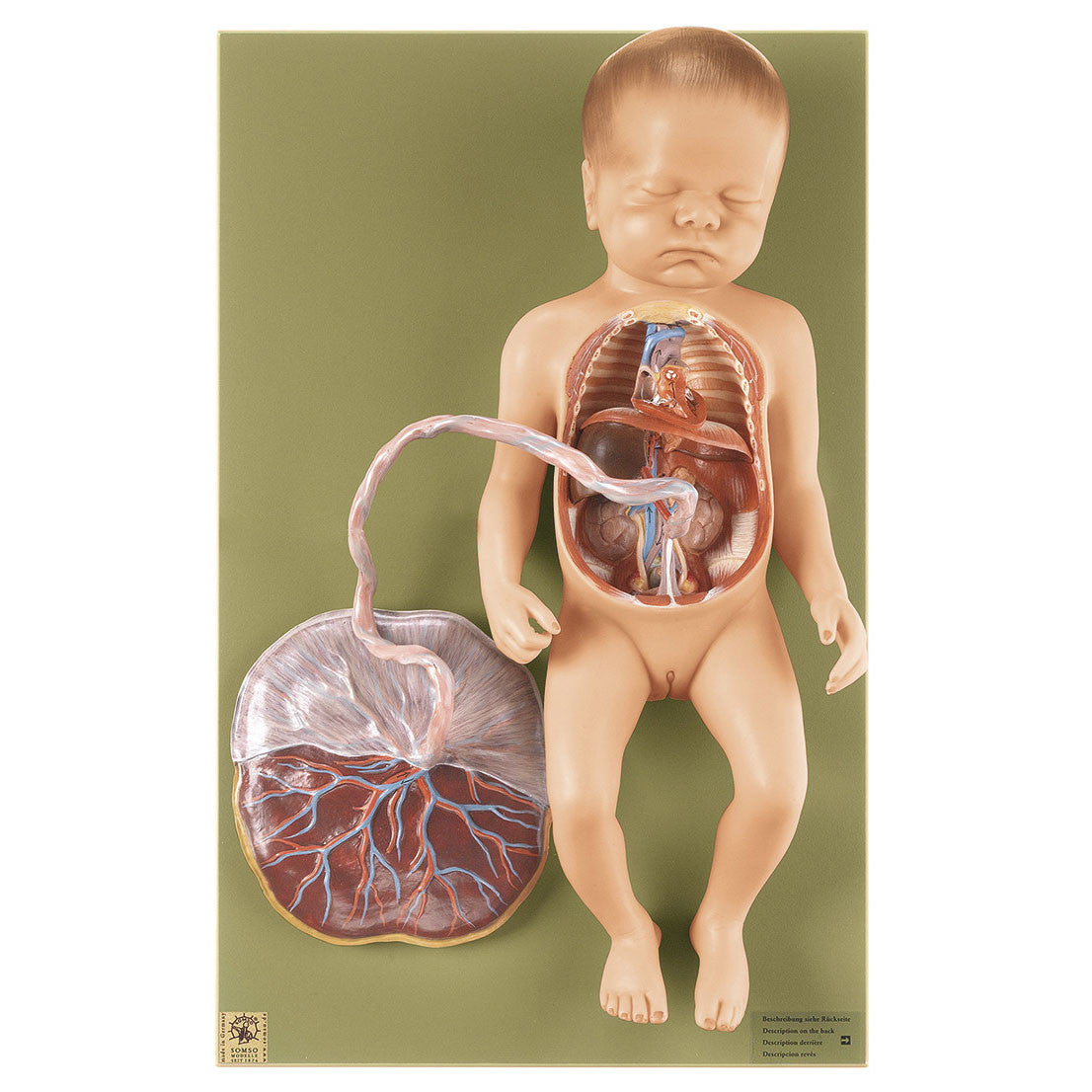 Fetal Circulatory System Somso Ms 16