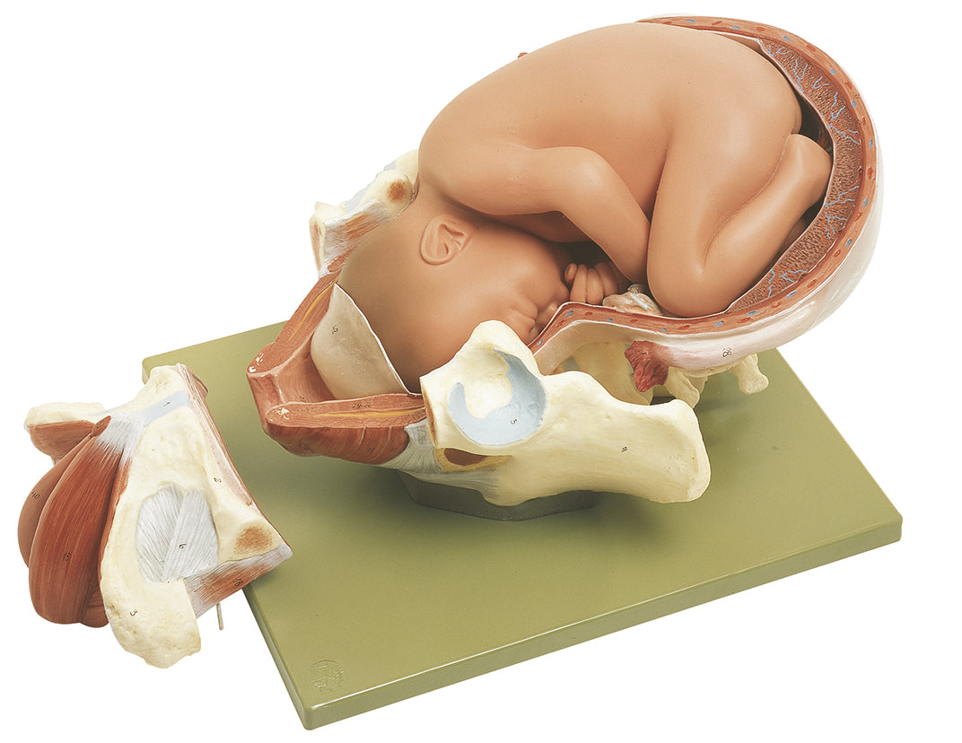 Birth - First Stage - Somso MS 45/1