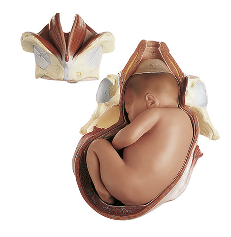 Birth - First Stage - Somso MS 45/1, view 2