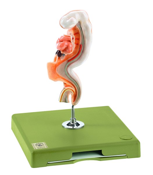 Human Embryo Model - Somso MS 48/3-1