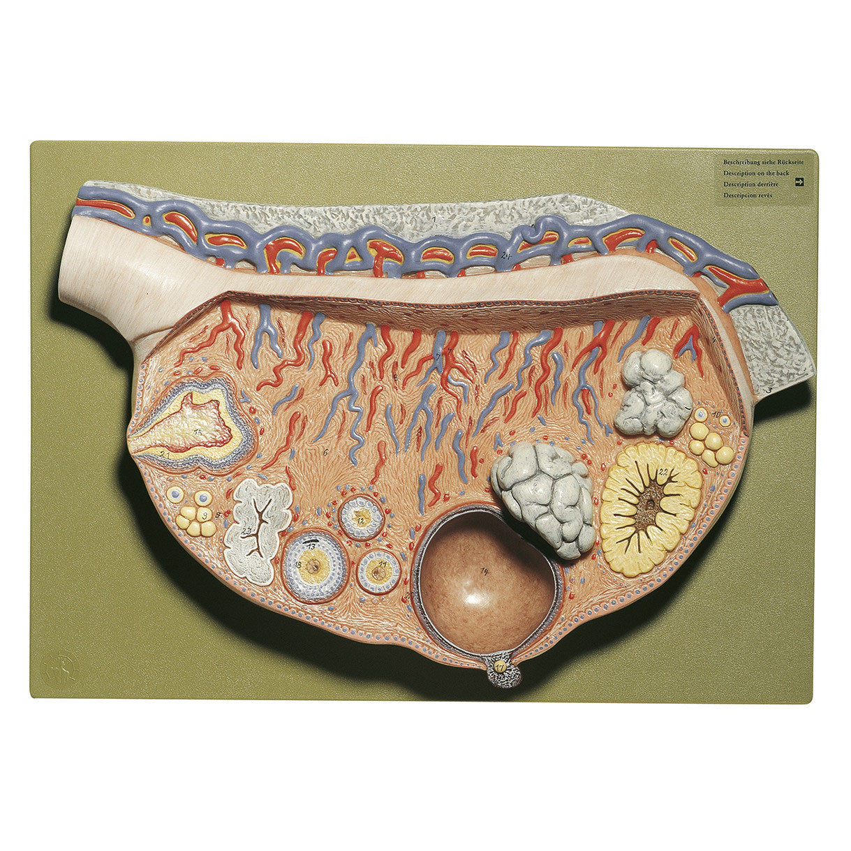 Relief Model of the Ovary Somso Ms 51