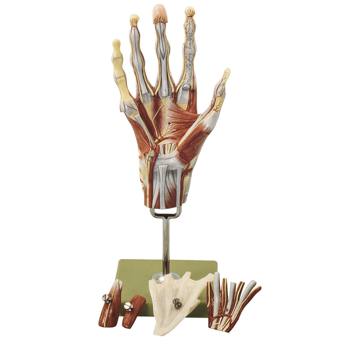 Muscles of the Hand with Base of the Forearm Somso Ns 13
