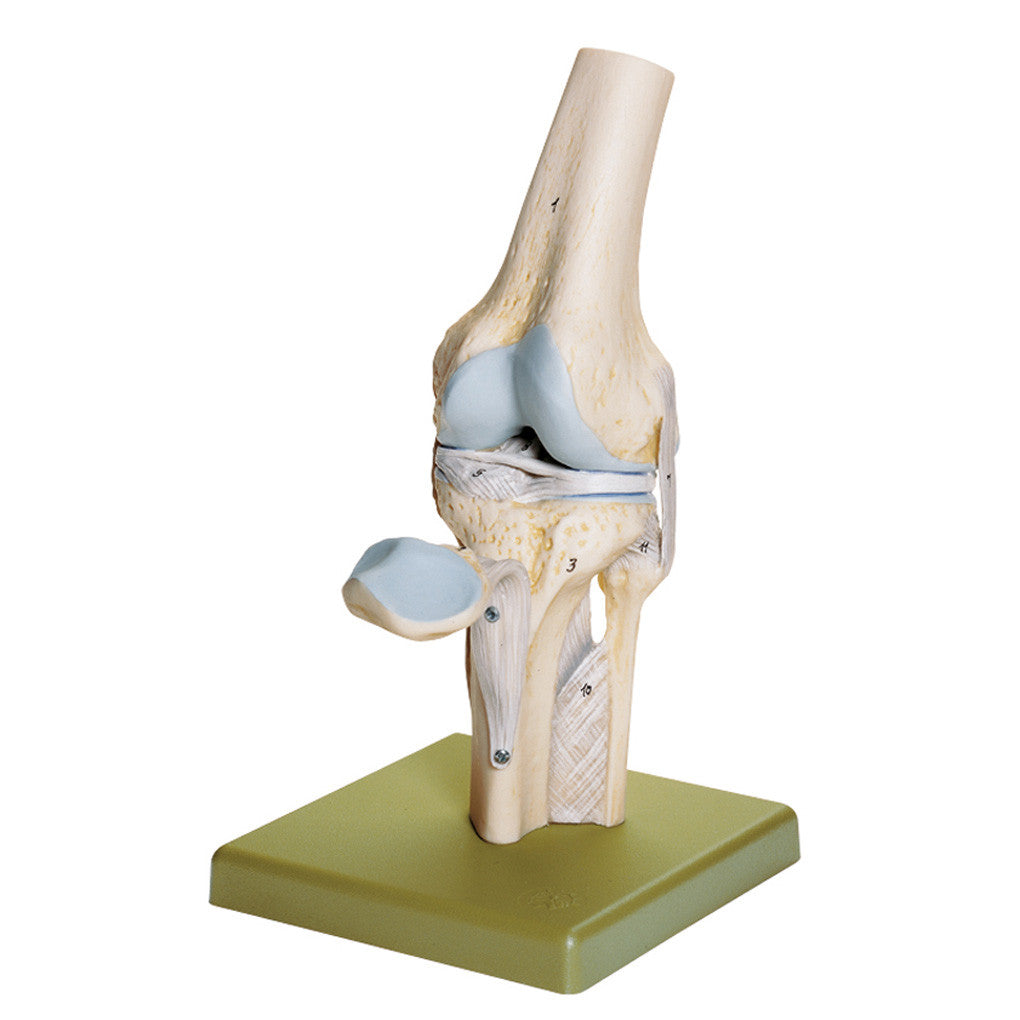 Knee Joint Model | Somso Ns 19