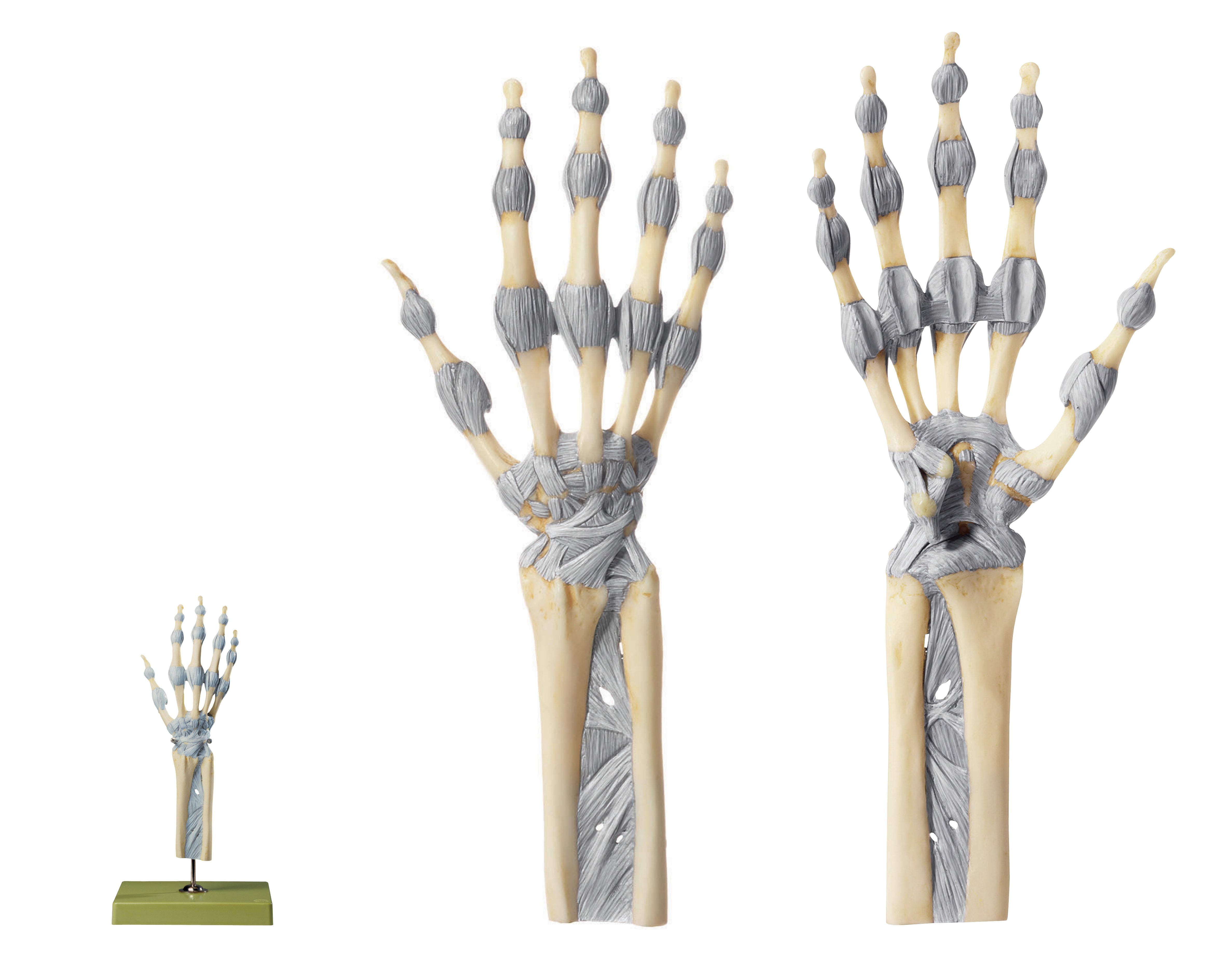 Joints of Hand and Fingers with Ligaments