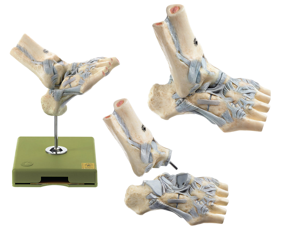 Ligaments of the Ankle with Open Talonavicular Joint