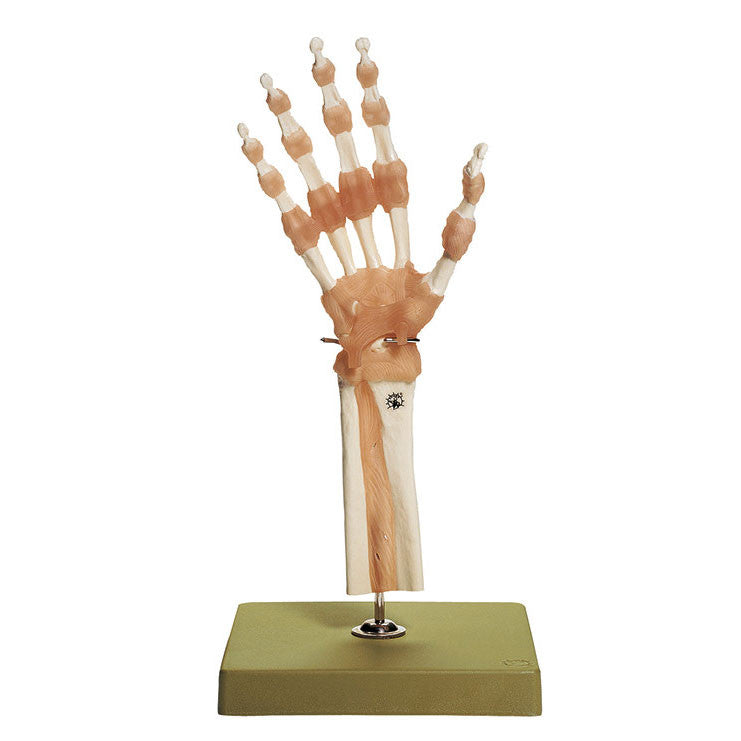 Functional Model of the Hand and Finger Joints Somso Ns 55