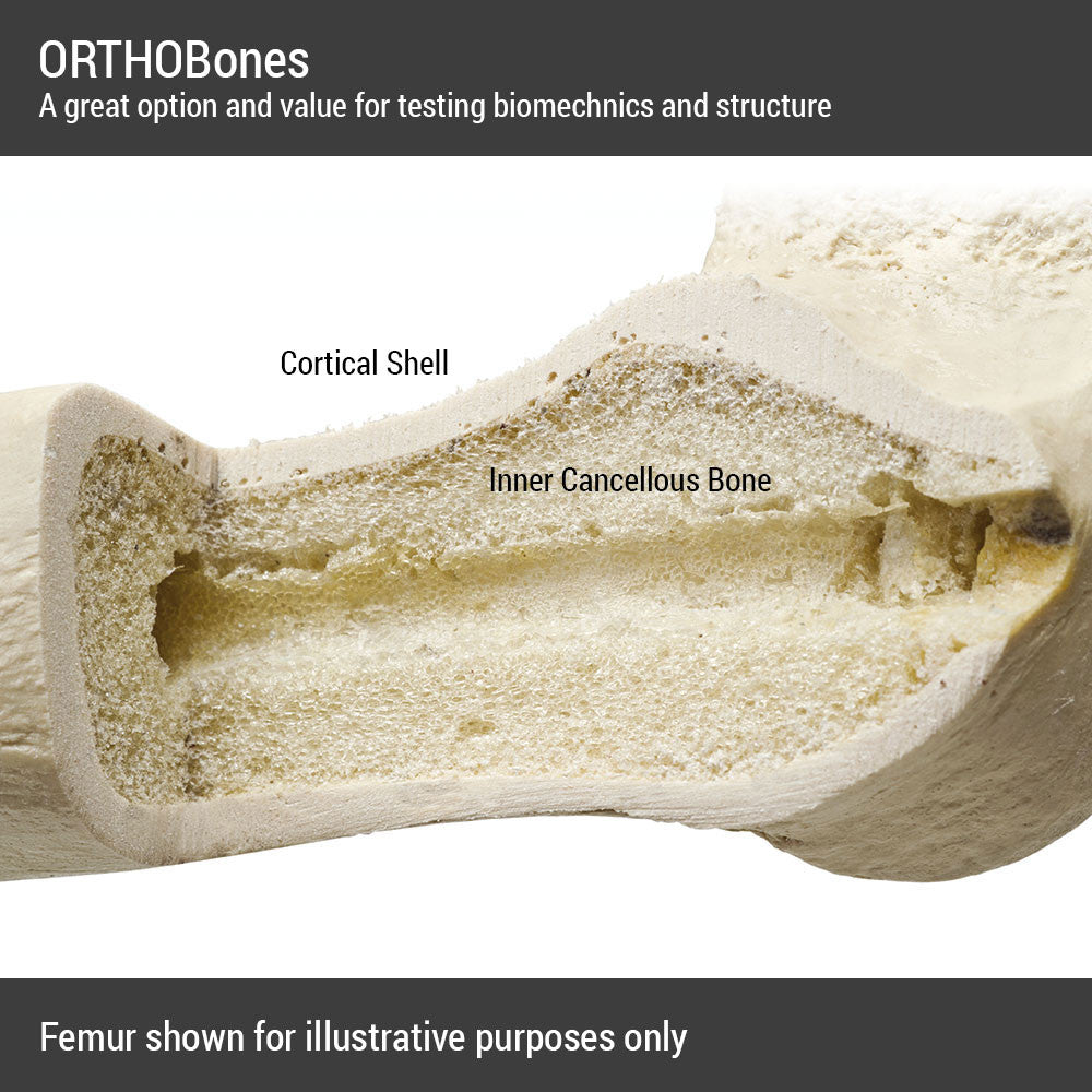 orthobones_bone_cross_section__32224.1589753252.1280.1280.jpg