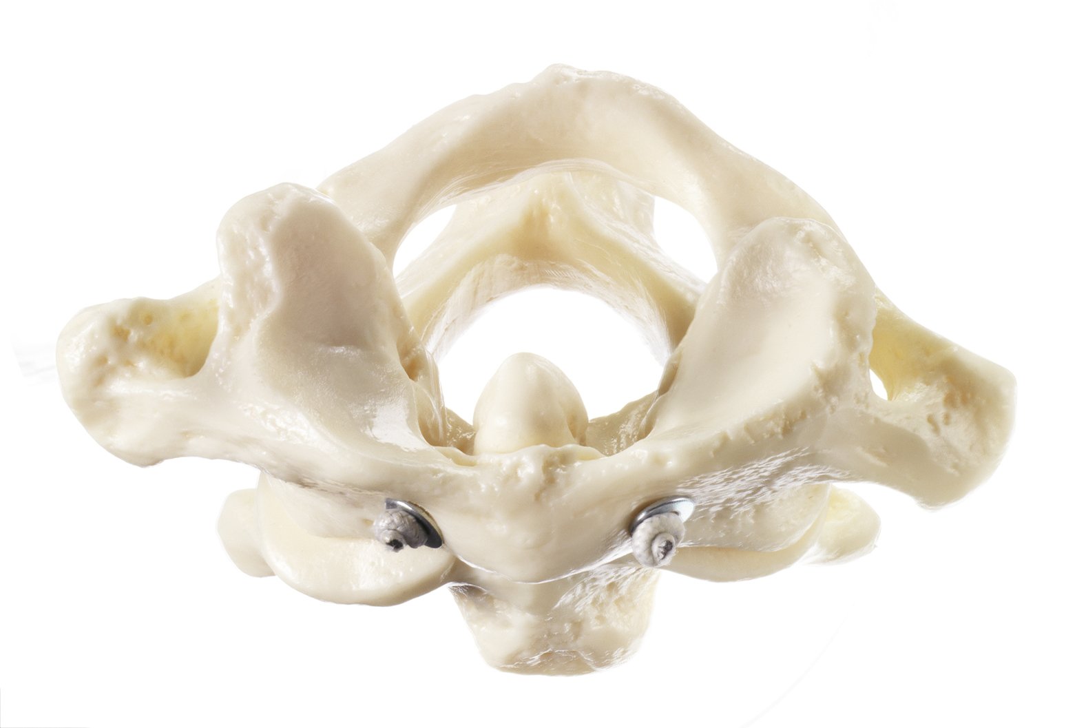 First and Second Cervical Vertebrae