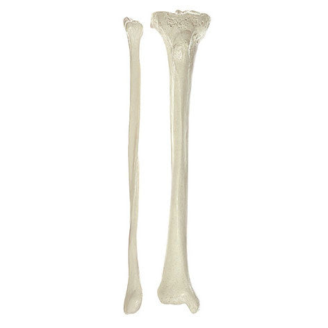 Tibia and Fibula Somso Qs 19/4