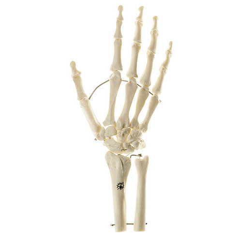 Skeleton of the Hand with Base of Forearm, numbered Somso Qs 31/1