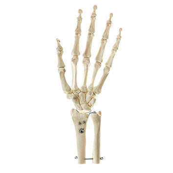 Skeleton of the Hand with Base of Forearm (Rigid) Somso Qs 31/2