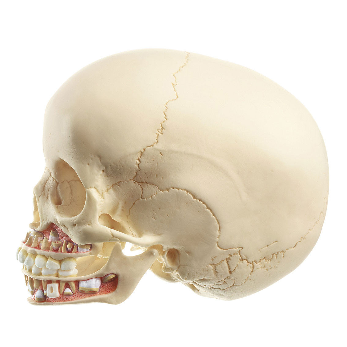 Artificial Skull of Child (Approx 6 Years Old) Somso Qs 3/2