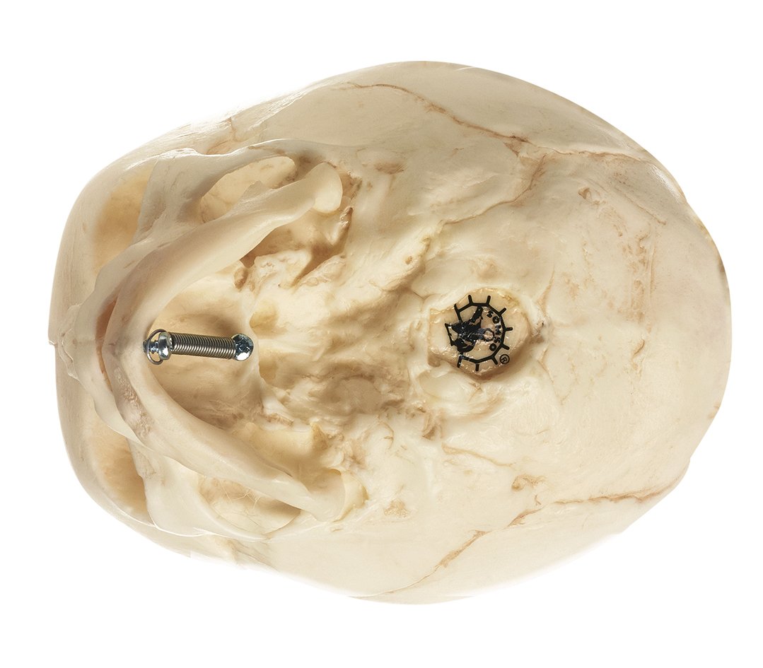 Artificial Skull of a Fetus