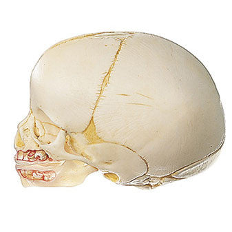 Artificial Skull of a Newborn Somso Qs 3