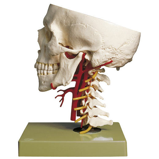 Artificial Base of Skull with Arteries Somso Qs 65/6