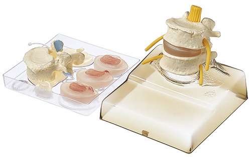 QS 68/8 intervertebral disc model, product photo
