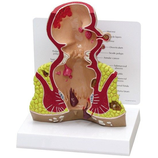 rectum-model-1-550x550__78584.1643511677.1280.1280.jpg
