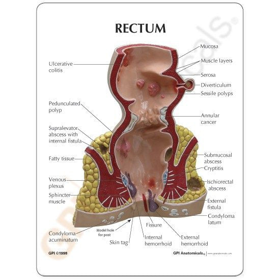 rectum-model-3-550x550__21069.1643511677.1280.1280.jpg