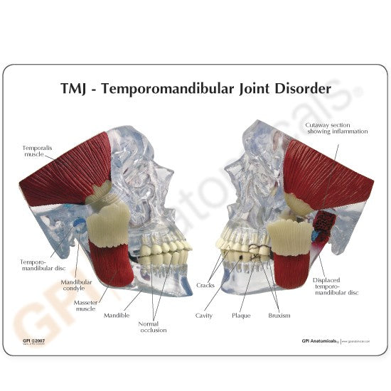Temporomandibular Joint (TMJ)