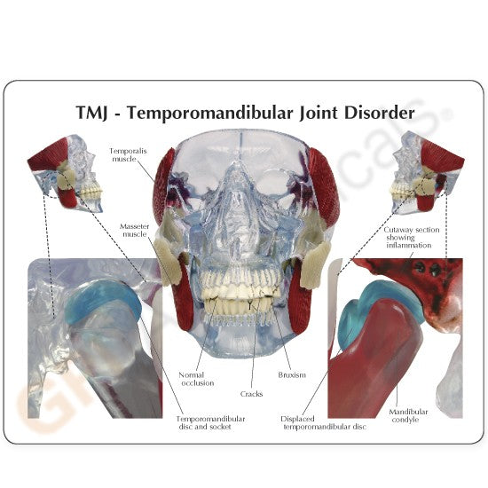 Temporomandibular Joint (TMJ)