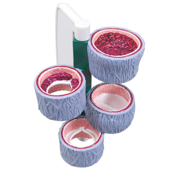 4-Piece Vein model