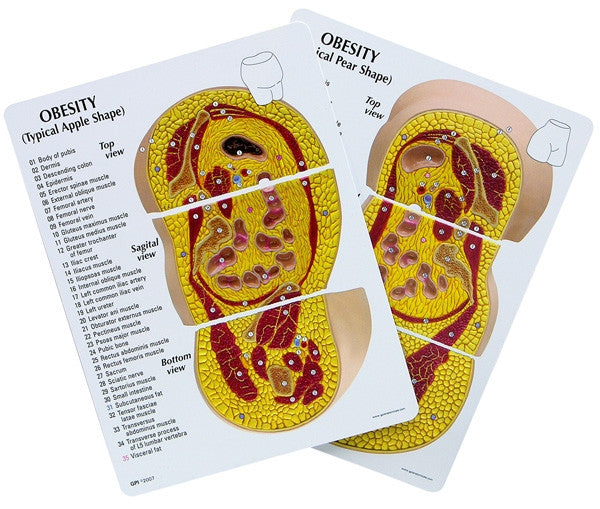 Obesity Model - GPI 3600 - educational cards