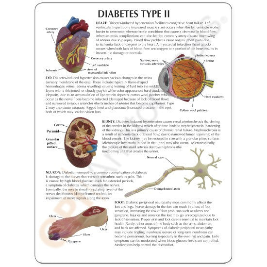 Type II Diabetes Set