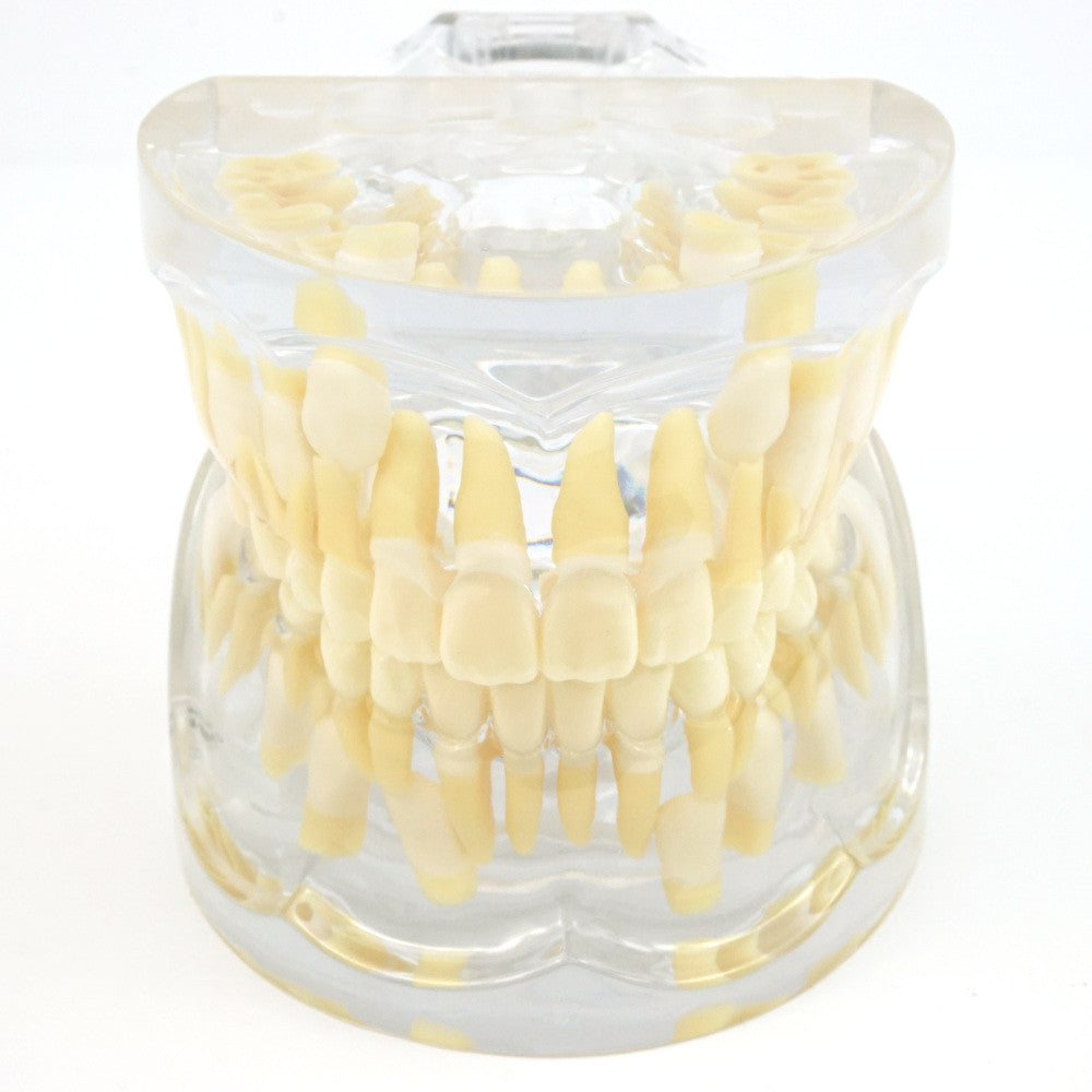 Mixed Dentition Model