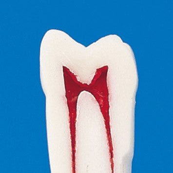 Nissin Permanent endo Teeth with Dental Pulp - cross section