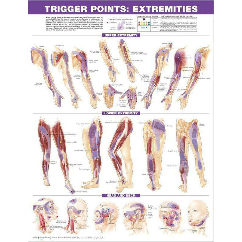 Trigger Point chart, Extremities